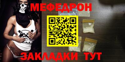 мет Обнинск